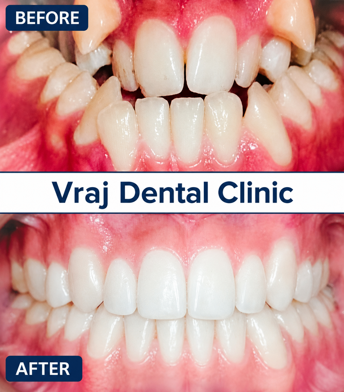 Orthodontic Treatment treatment