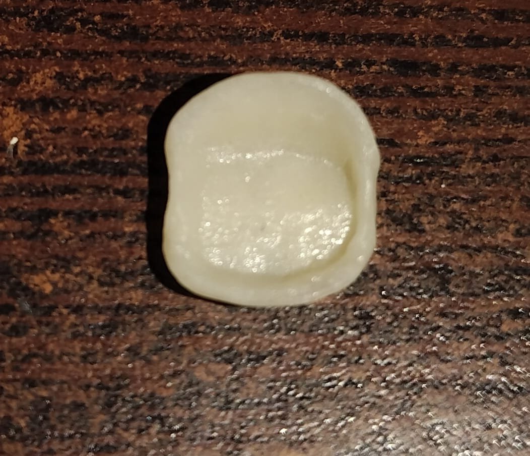 Zirconia Cap treatment